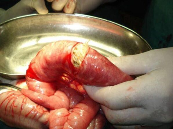 Like worms are dangerous