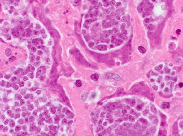 Research of parasites in a person