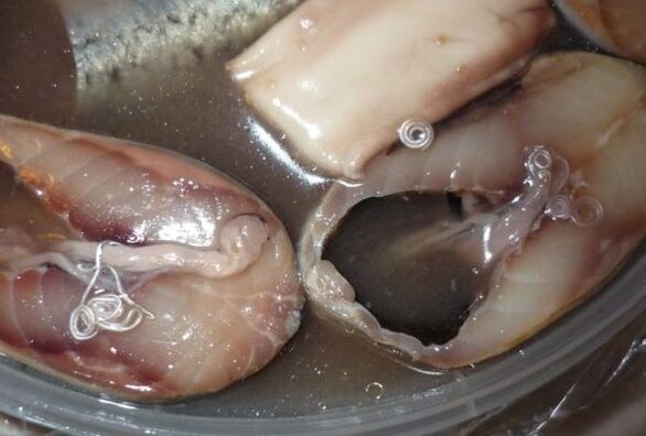 routes of infection by human parasites