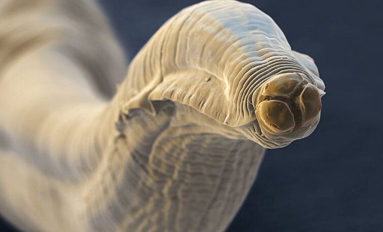 a worm parasite from the human body