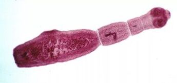 How to get rid of the parasites of the human body