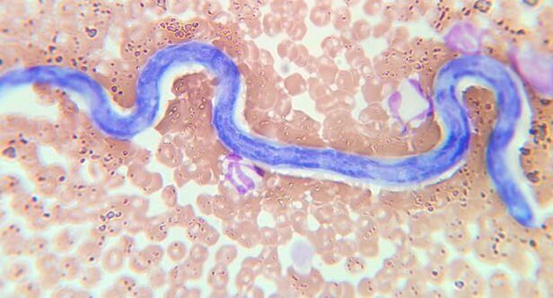 Intestinal worm