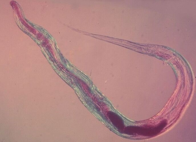 Pinworm under a microscope