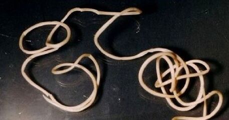 Yarn